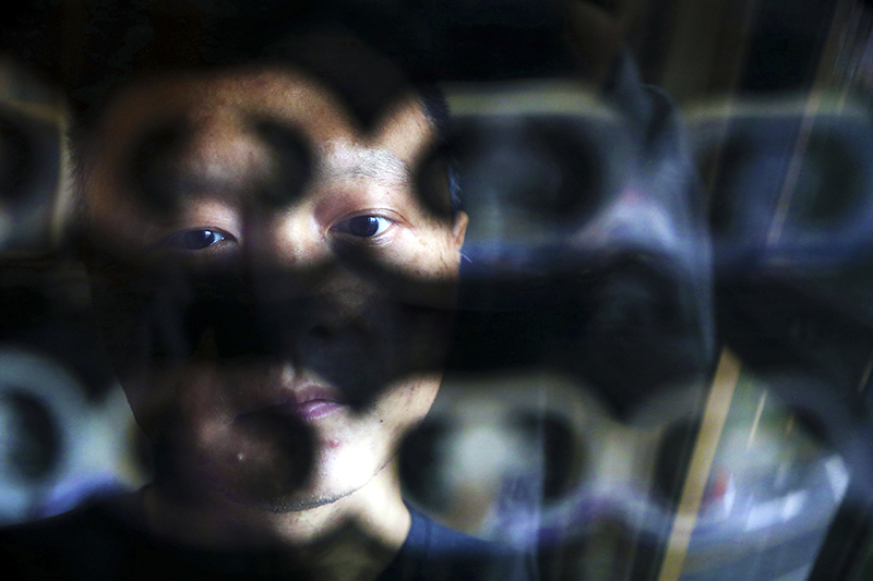 Blushing with health, doctor says thanks “黑臉醫(yī)生”艱難重生記